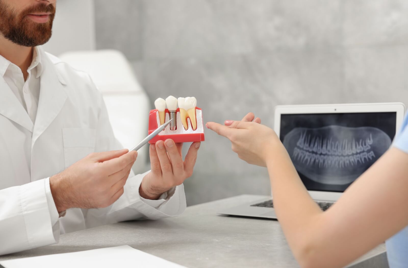 A dentist showing a model of dental implants and discussing the procedure with a patient.
