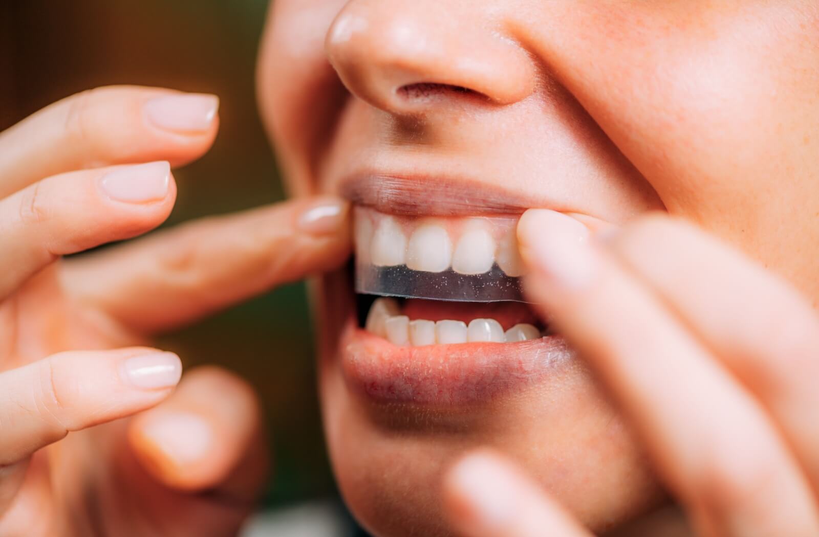 A person applies a clear whitening strip to their teeth, one of the various methods that can be done at home.